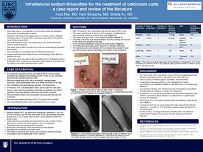 24 Hour Fast Poster Printing - Large Poster up to 60 x 100 inch in 2 - 4 hours